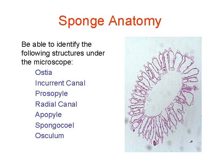 Sponge Anatomy Be able to identify the following structures under the microscope: Ostia Incurrent
