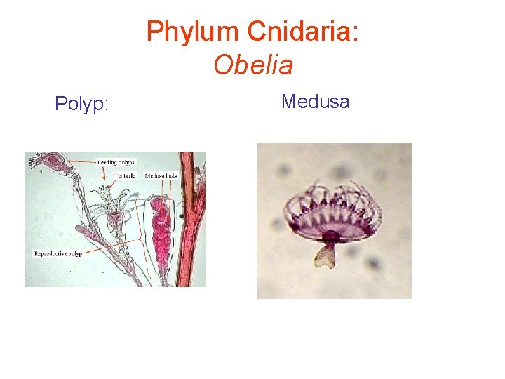 Phylum Cnidaria: Obelia Polyp: Medusa 