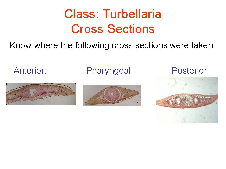 Class: Turbellaria Cross Sections Know where the following cross sections were taken Anterior: Pharyngeal