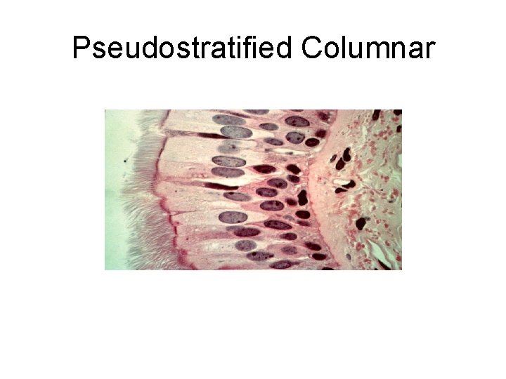 Pseudostratified Columnar 