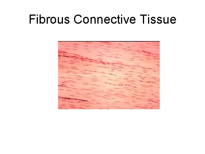 Fibrous Connective Tissue 