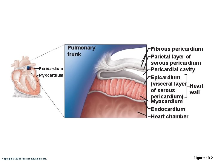 Pulmonary trunk Pericardium Myocardium Copyright © 2010 Pearson Education, Inc. Fibrous pericardium Parietal layer