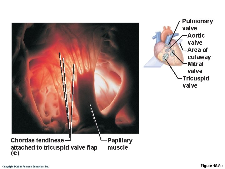 Pulmonary valve Aortic valve Area of cutaway Mitral valve Tricuspid valve Chordae tendineae attached
