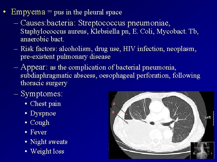  • Empyema = pus in the pleural space – Causes: bacteria: Streptococcus pneumoniae,