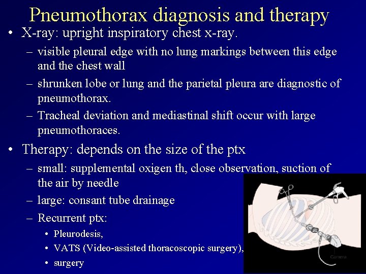 Pneumothorax diagnosis and therapy • X-ray: upright inspiratory chest x-ray. – visible pleural edge