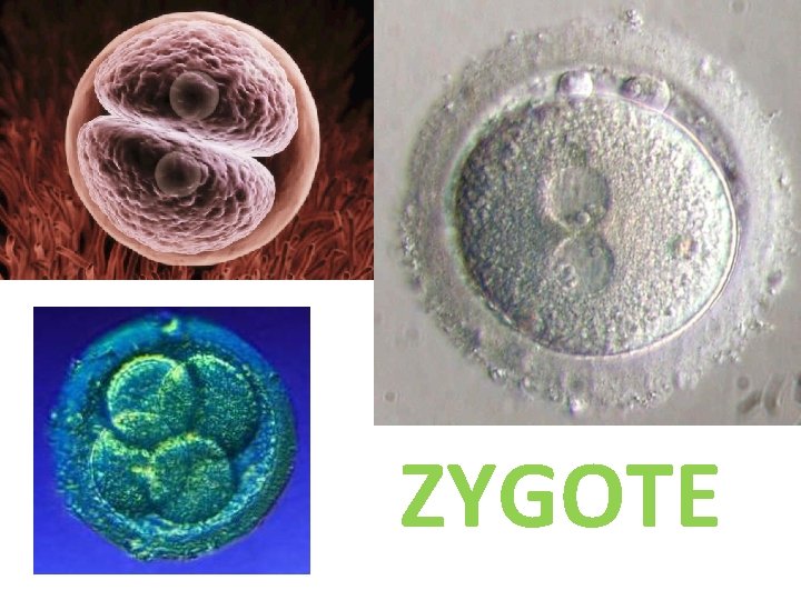 ZYGOTE 