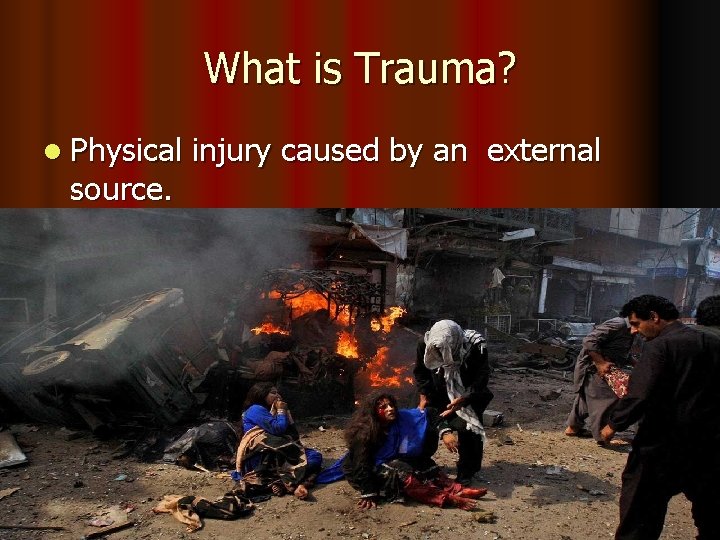 What is Trauma? l Physical injury caused by an external source. S-IV, JHL 