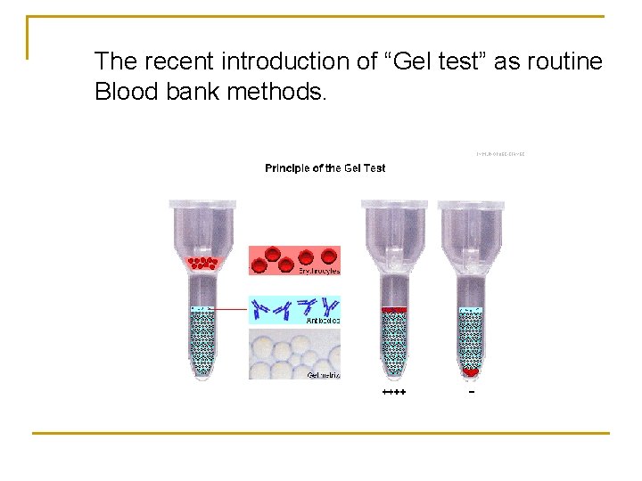 The recent introduction of “Gel test” as routine Blood bank methods. 