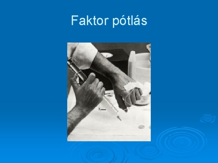 Faktor pótlás 