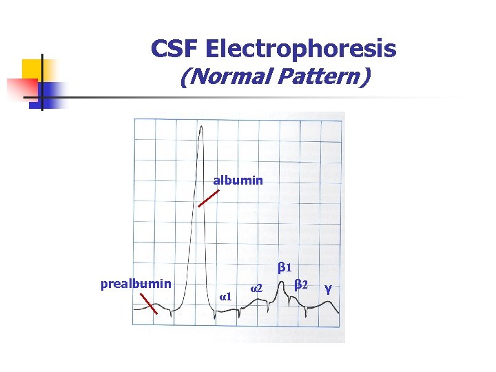 CSF Electrophoresis (Normal Pattern) albumin β 1 prealbumin α 1 α 2 β 2