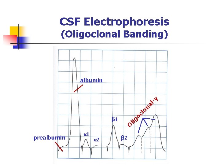 CSF Electrophoresis (Oligoclonal Banding) β 1 prealbumin α 1 α 2 O lig oc
