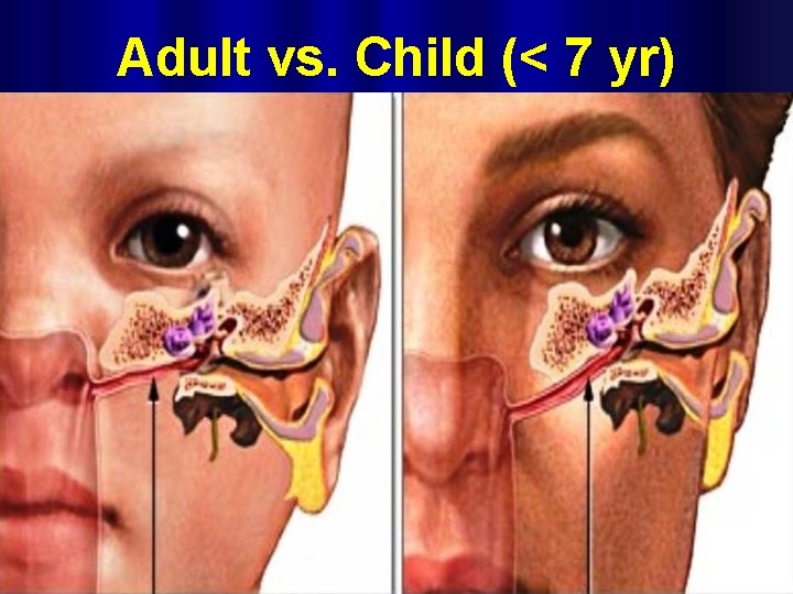 Adult vs. Child (< 7 yr) 
