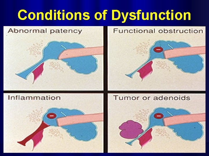 Conditions of Dysfunction 