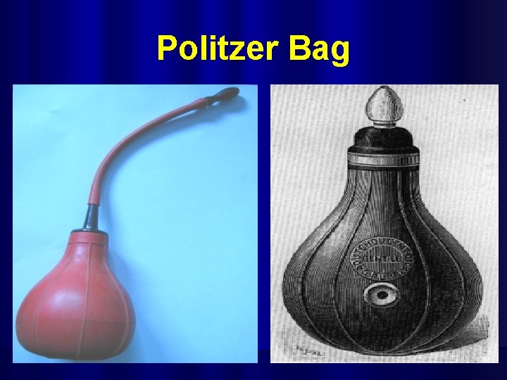 Politzer Bag 