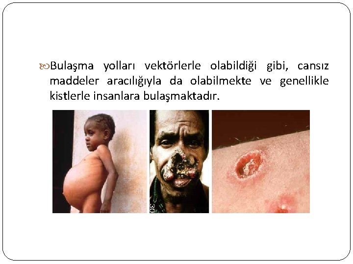  Bulaşma yolları vektörlerle olabildiği gibi, cansız maddeler aracılığıyla da olabilmekte ve genellikle kistlerle
