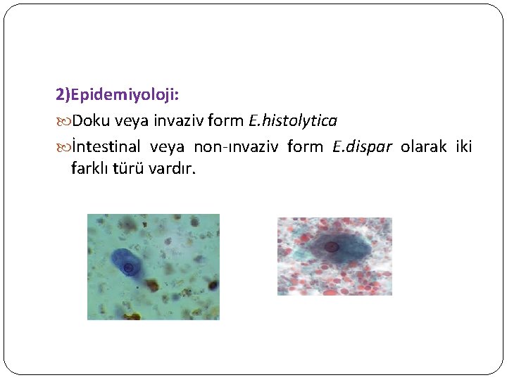 2)Epidemiyoloji: Doku veya invaziv form E. histolytica İntestinal veya non-ınvaziv form E. dispar olarak