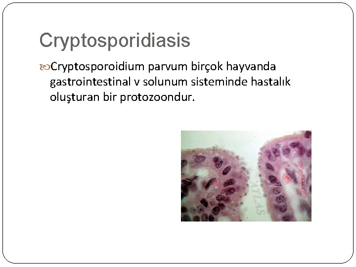 Cryptosporidiasis Cryptosporoidium parvum birçok hayvanda gastrointestinal v solunum sisteminde hastalık oluşturan bir protozoondur. 