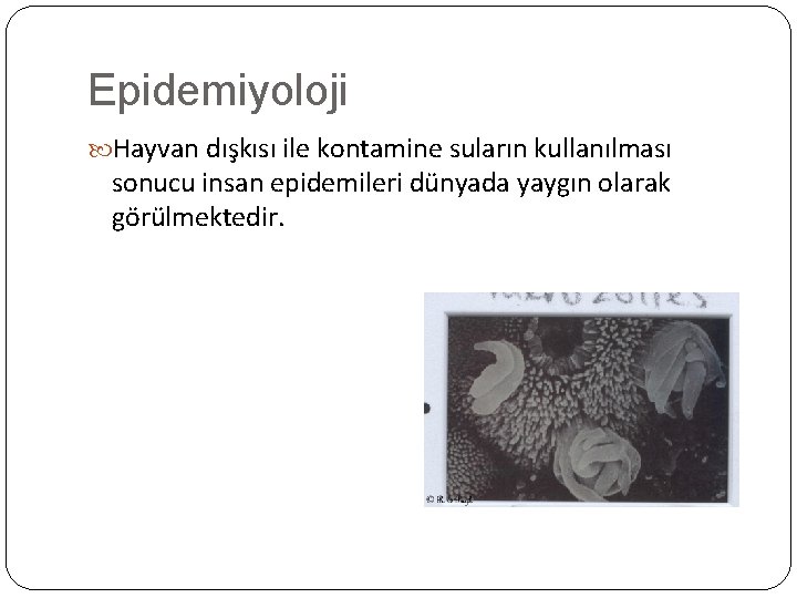 Epidemiyoloji Hayvan dışkısı ile kontamine suların kullanılması sonucu insan epidemileri dünyada yaygın olarak görülmektedir.