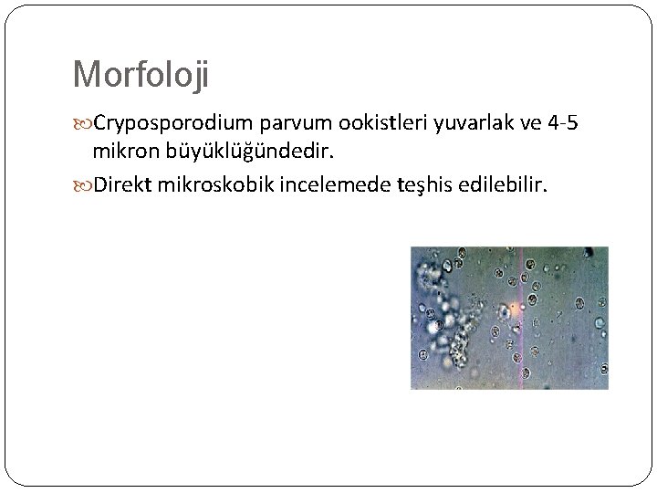 Morfoloji Cryposporodium parvum ookistleri yuvarlak ve 4 -5 mikron büyüklüğündedir. Direkt mikroskobik incelemede teşhis