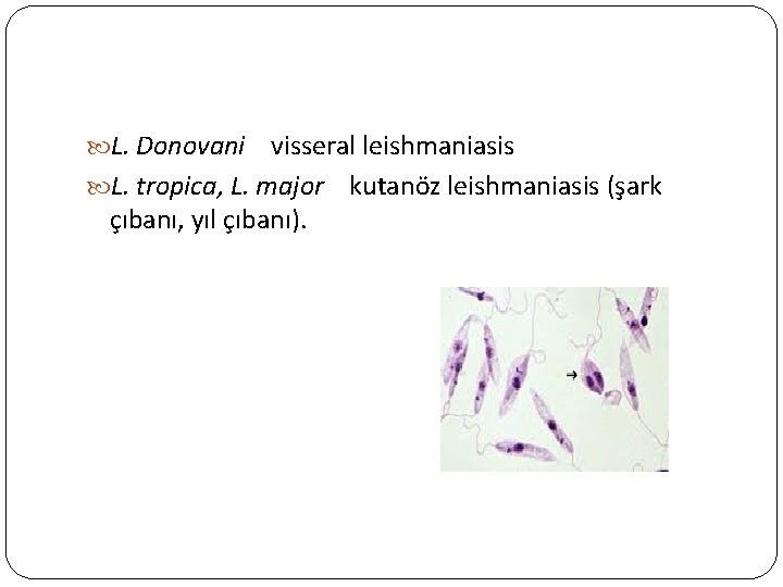  L. Donovani visseral leishmaniasis L. tropica, L. major kutanöz leishmaniasis (şark çıbanı, yıl