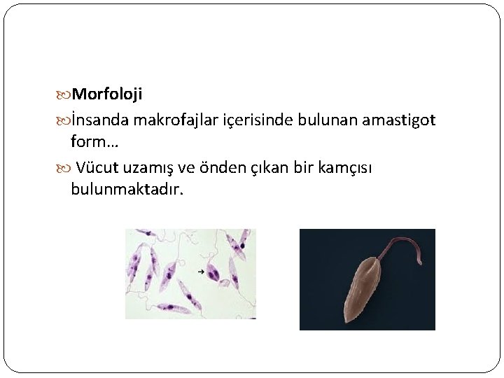  Morfoloji İnsanda makrofajlar içerisinde bulunan amastigot form… Vücut uzamış ve önden çıkan bir