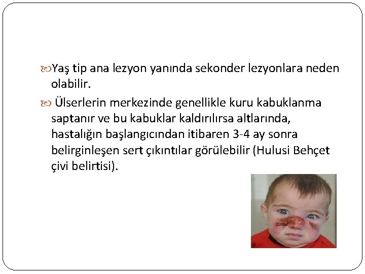  Yaş tip ana lezyon yanında sekonder lezyonlara neden olabilir. Ülserlerin merkezinde genellikle kuru