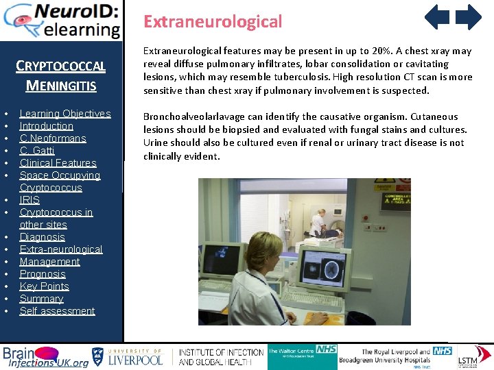 Extraneurological CRYPTOCOCCAL MENINGITIS • • • • Learning Objectives Introduction C. Neoformans C. Gatti