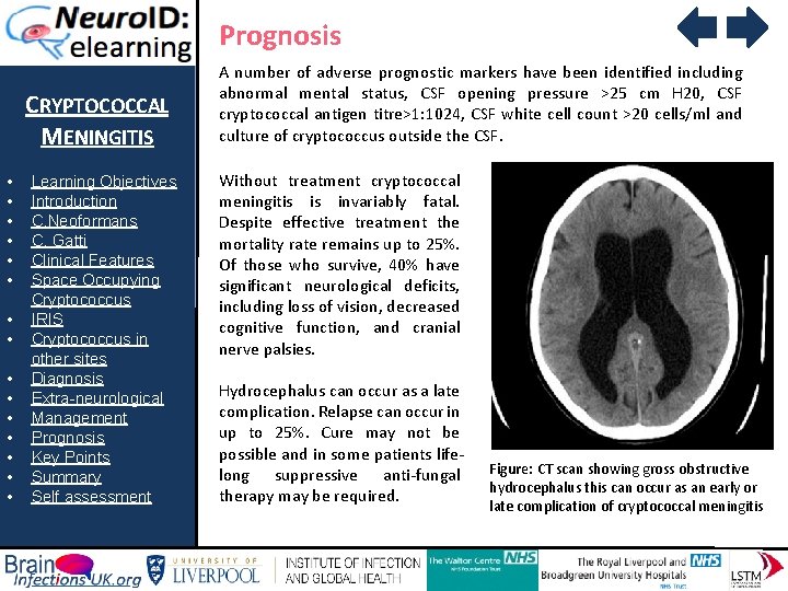Prognosis CRYPTOCOCCAL MENINGITIS • • • • Learning Objectives Introduction C. Neoformans C. Gatti