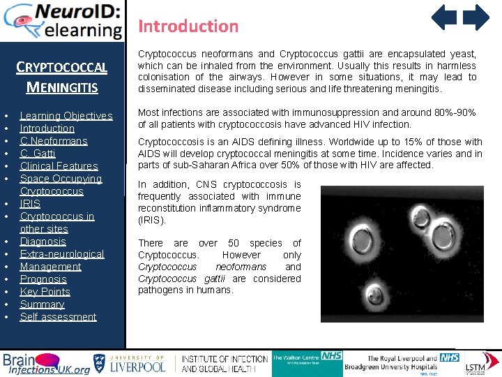 Introduction CRYPTOCOCCAL MENINGITIS • • • • Learning Objectives Introduction C. Neoformans C. Gatti
