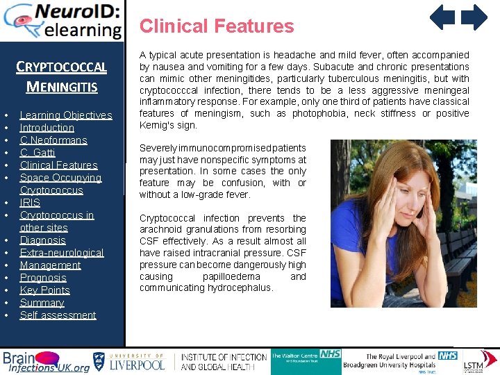 Clinical Features CRYPTOCOCCAL MENINGITIS • • • • Learning Objectives Introduction C. Neoformans C.