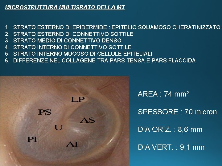 MICROSTRUTTURA MULTISRATO DELLA MT 1. 2. 3. 4. 5. 6. STRATO ESTERNO DI EPIDERMIDE