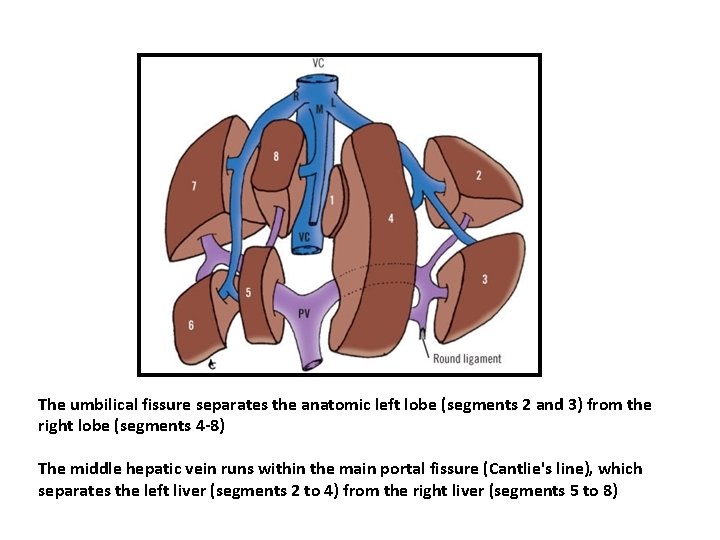 The umbilical fissure separates the anatomic left lobe (segments 2 and 3) from the The umbilical fissure separates the anatomic left lobe (segments 2 and 3) from the