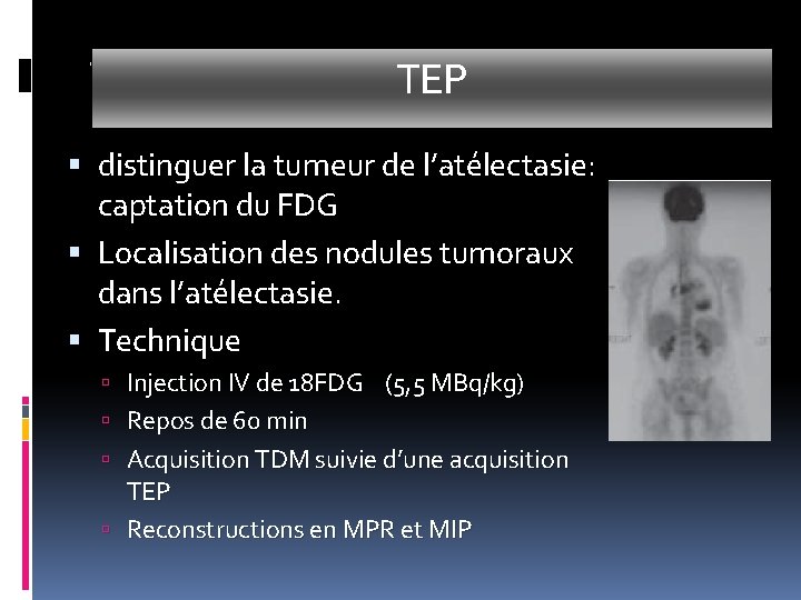TEP distinguer la tumeur de l’atélectasie: captation du FDG Localisation des nodules tumoraux dans TEP distinguer la tumeur de l’atélectasie: captation du FDG Localisation des nodules tumoraux dans