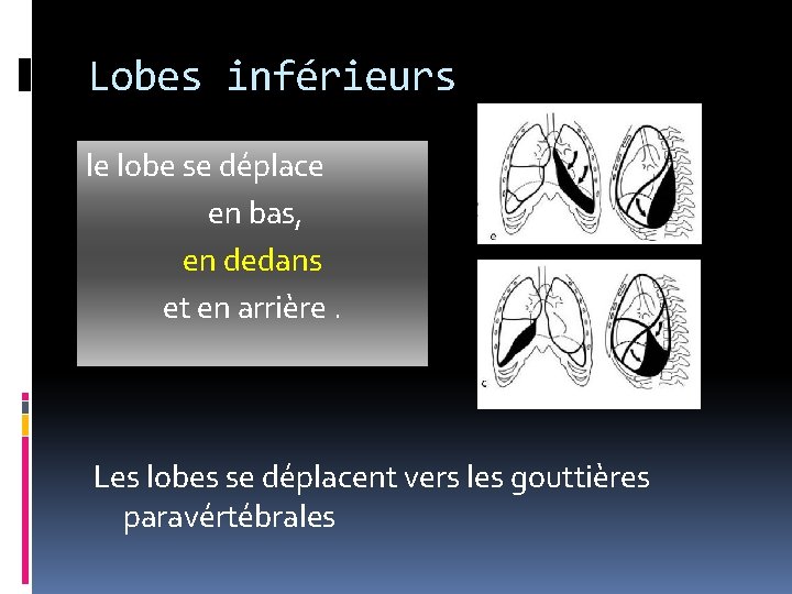 Lobes inférieurs le lobe se déplace en bas, en dedans et en arrière. Les Lobes inférieurs le lobe se déplace en bas, en dedans et en arrière. Les