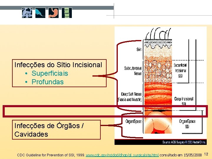 Infecções do Sítio Incisional • Superficiais • Profundas 1 Infecções de Órgãos / Cavidades