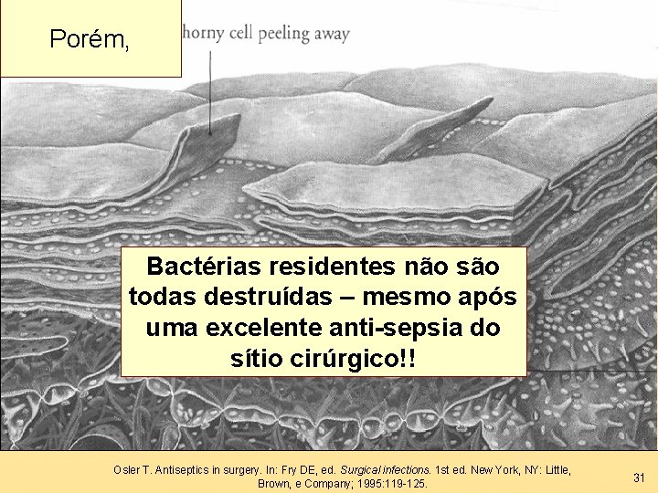 Porém, Bactérias residentes não são todas destruídas – mesmo após uma excelente anti-sepsia do