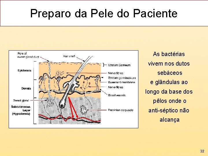 Preparo da Pele do Paciente As bactérias vivem nos dutos sebáceos e glândulas ao