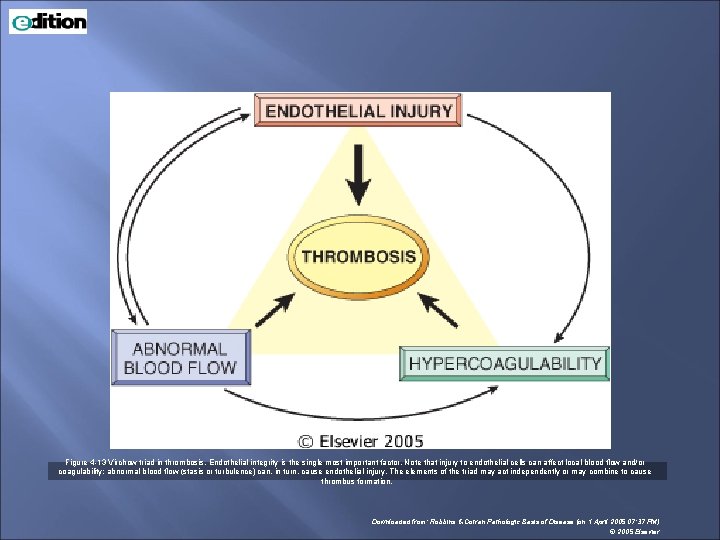 Figure 4 -13 Virchow triad in thrombosis. Endothelial integrity is the single most important