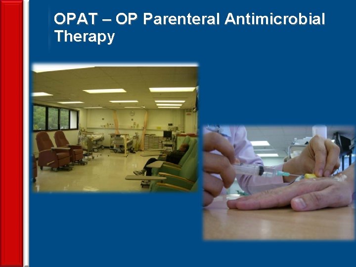 OPAT – OP Parenteral Antimicrobial Therapy 41 