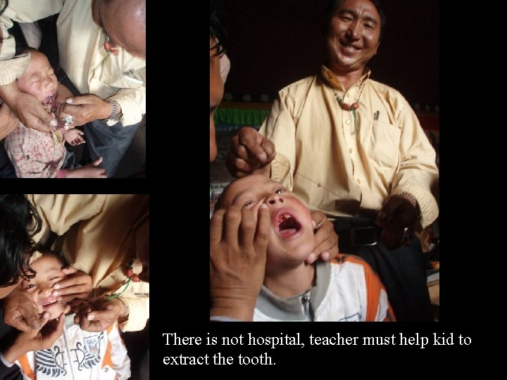 There is not hospital, teacher must help kid to extract the tooth. 