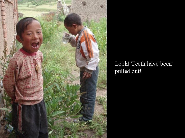 Look! Teeth have been pulled out! 