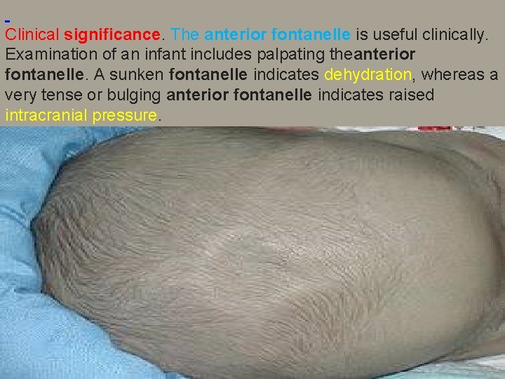  Clinical significance. The anterior fontanelle is useful clinically. Examination of an infant includes