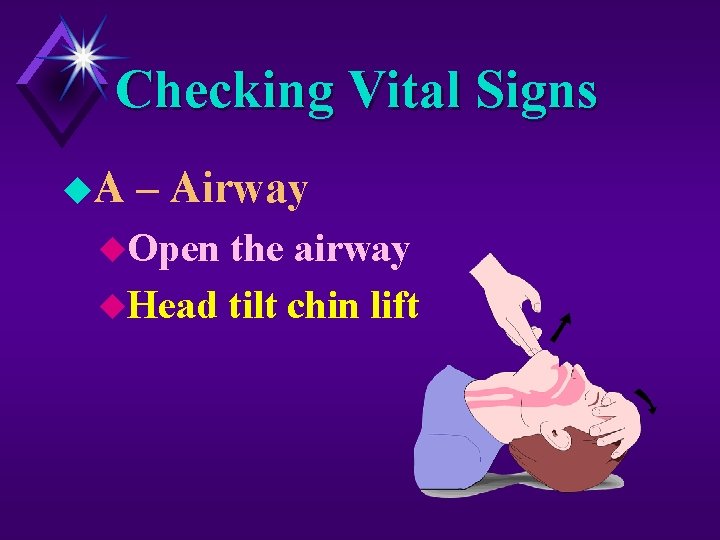 Checking Vital Signs u. A – Airway u. Open the airway u. Head tilt