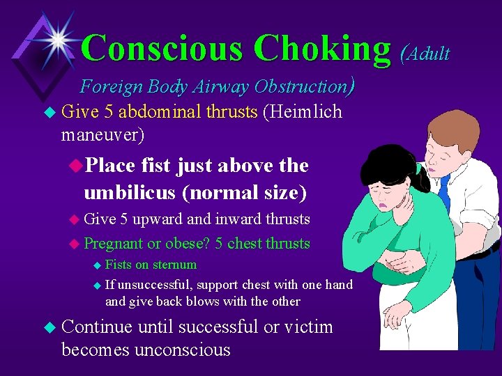 Conscious Choking (Adult Foreign Body Airway Obstruction) u Give 5 abdominal thrusts (Heimlich maneuver)