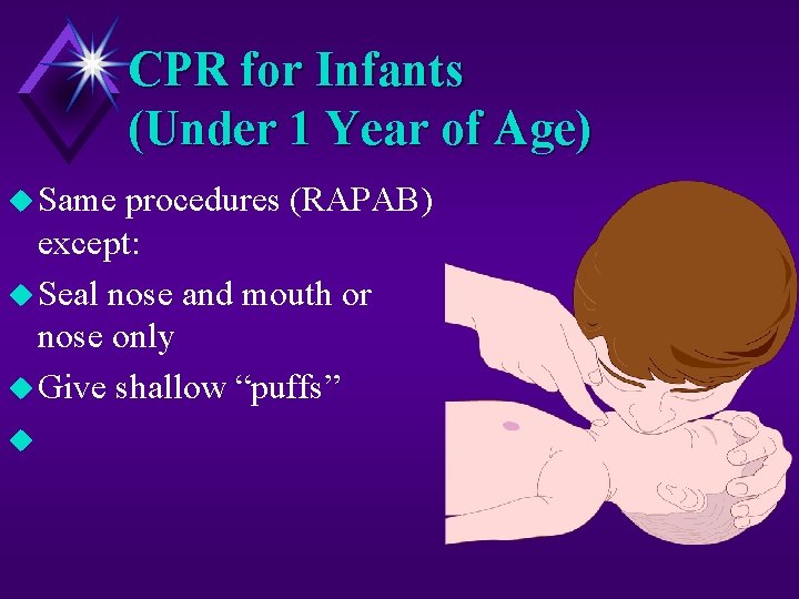 CPR for Infants (Under 1 Year of Age) u Same procedures (RAPAB) except: u