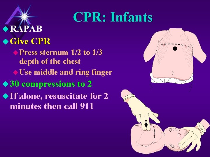 u RAPAB u Give CPR: Infants CPR u Press sternum 1/2 to 1/3 depth