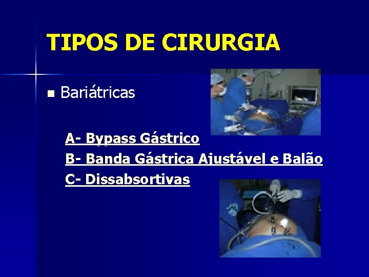 TIPOS DE CIRURGIA n Bariátricas A- Bypass Gástrico B- Banda Gástrica Ajustável e Balão