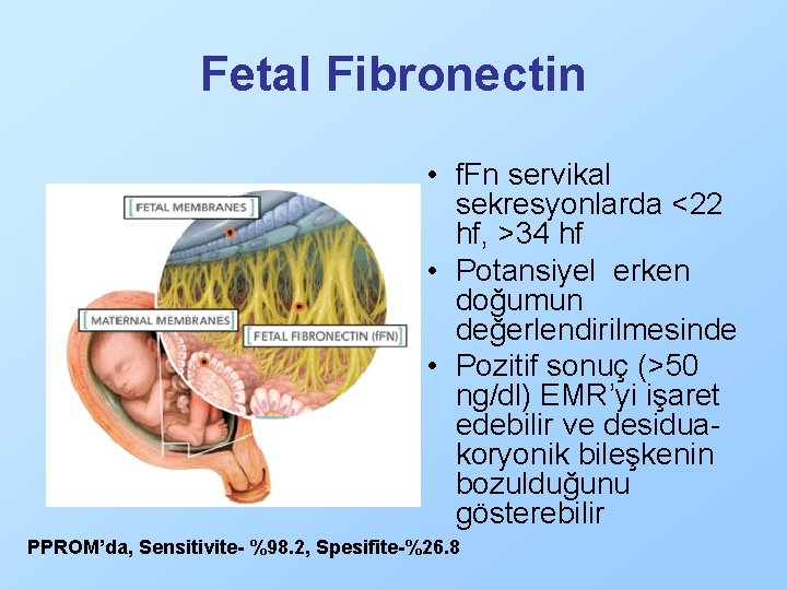 Fetal Fibronectin • f. Fn servikal sekresyonlarda <22 hf, >34 hf • Potansiyel erken