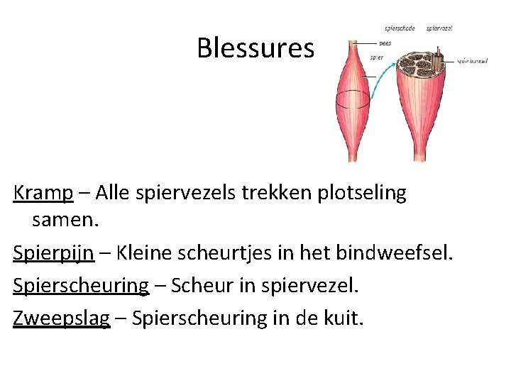 Blessures Kramp – Alle spiervezels trekken plotseling samen. Spierpijn – Kleine scheurtjes in het