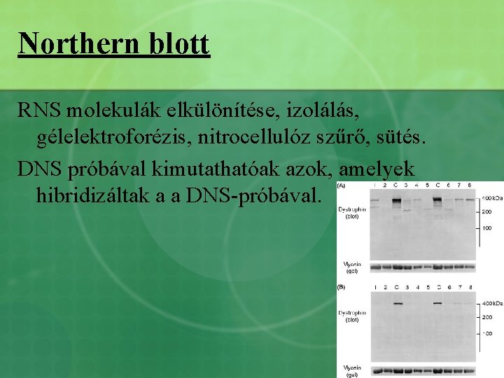 Northern blott RNS molekulák elkülönítése, izolálás, gélelektroforézis, nitrocellulóz szűrő, sütés. DNS próbával kimutathatóak azok,
